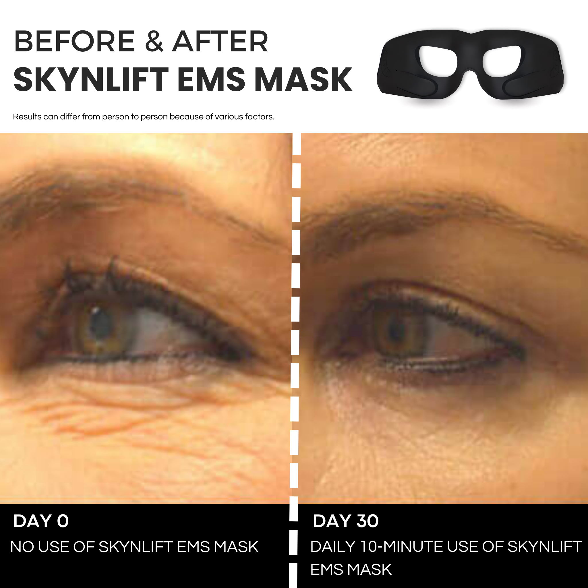 SKYNLIFT™ EMS EYE MASK