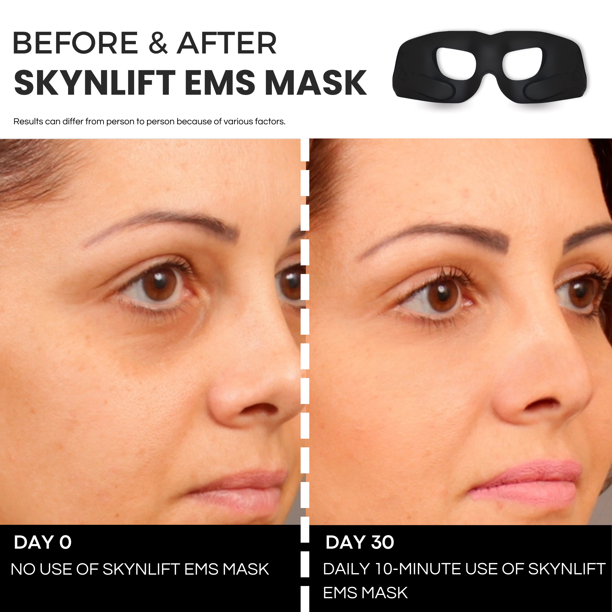 SKYNLIFT™ EMS EYE MASK