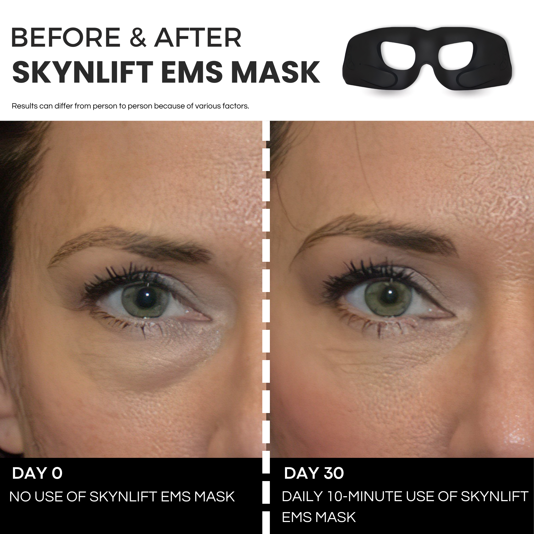 SKYNLIFT™ EMS EYE MASK