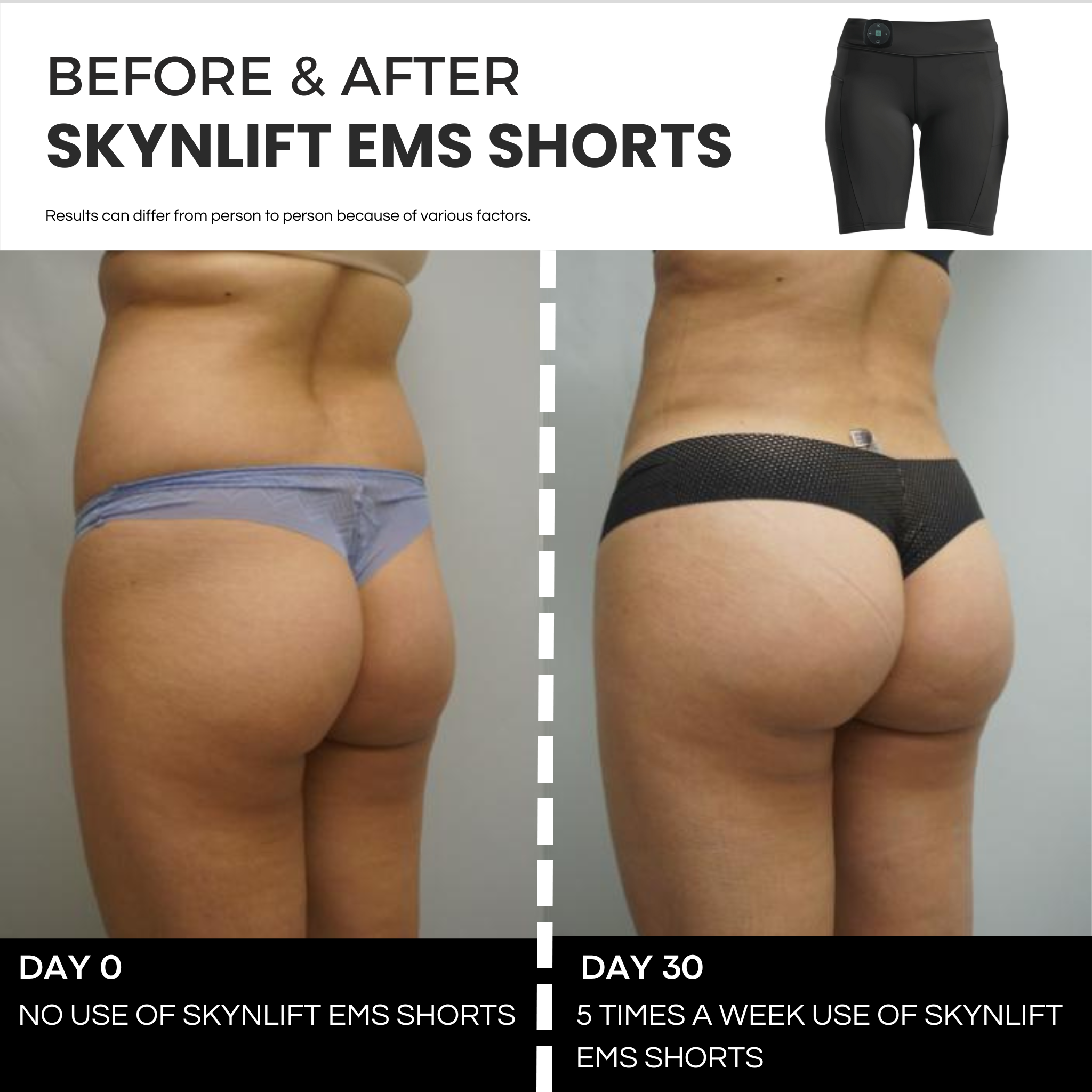 SKYNLIFT™ EMS TONING SHORTS