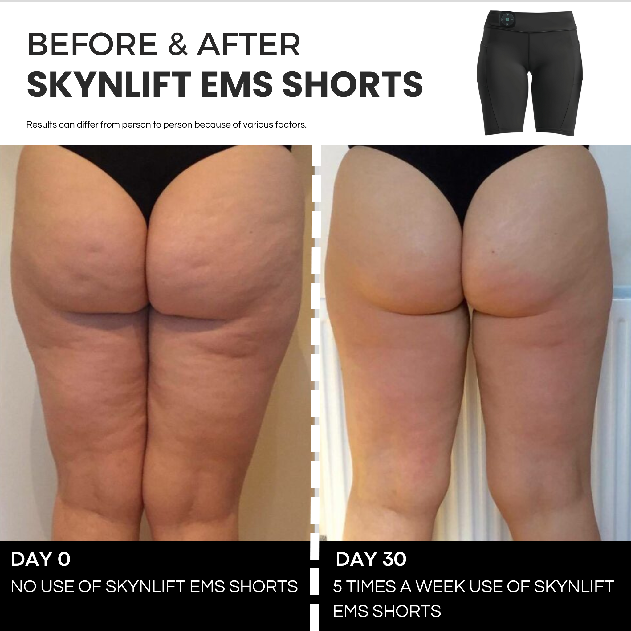 SKYNLIFT™ EMS TONING SHORTS