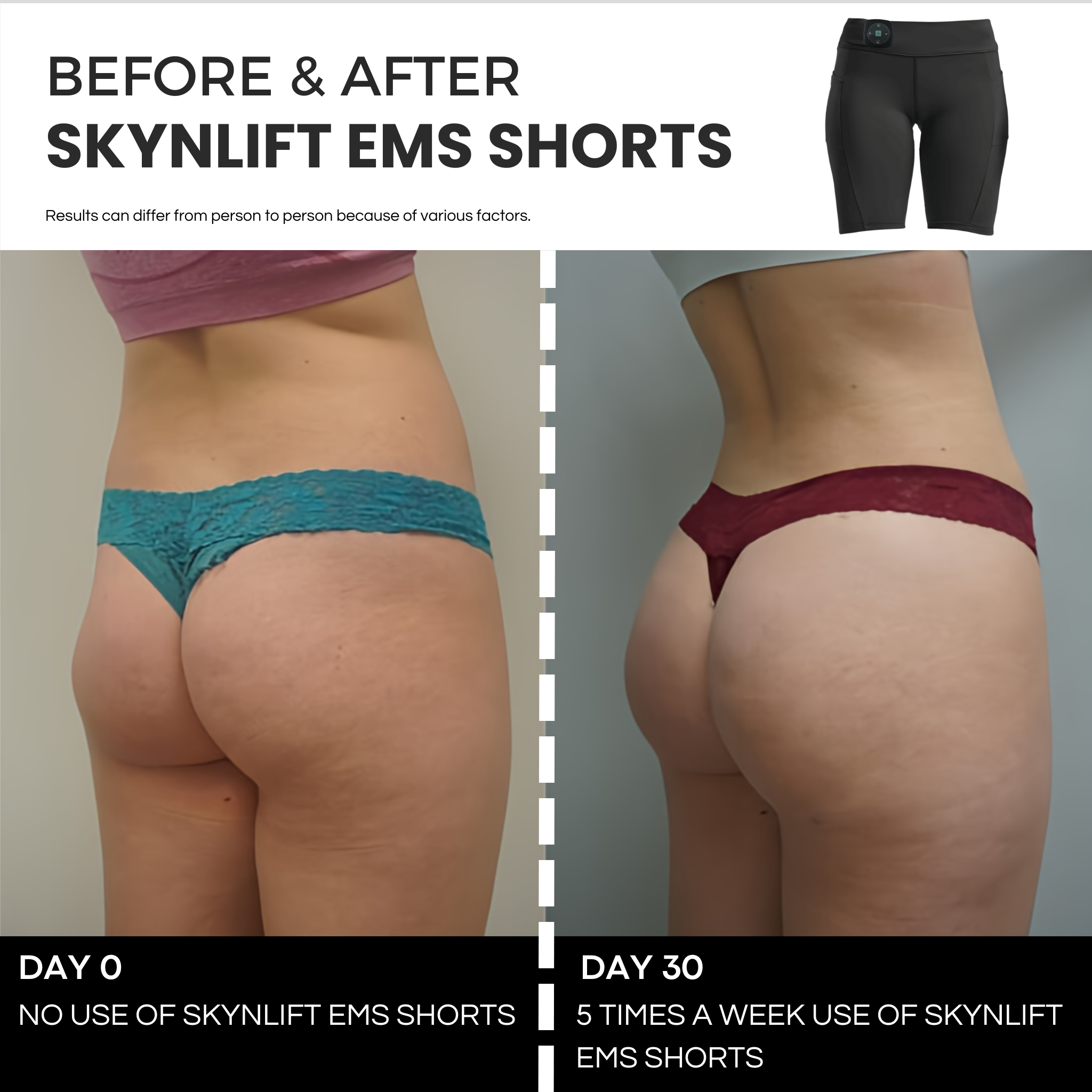 SKYNLIFT™ EMS TONING SHORTS