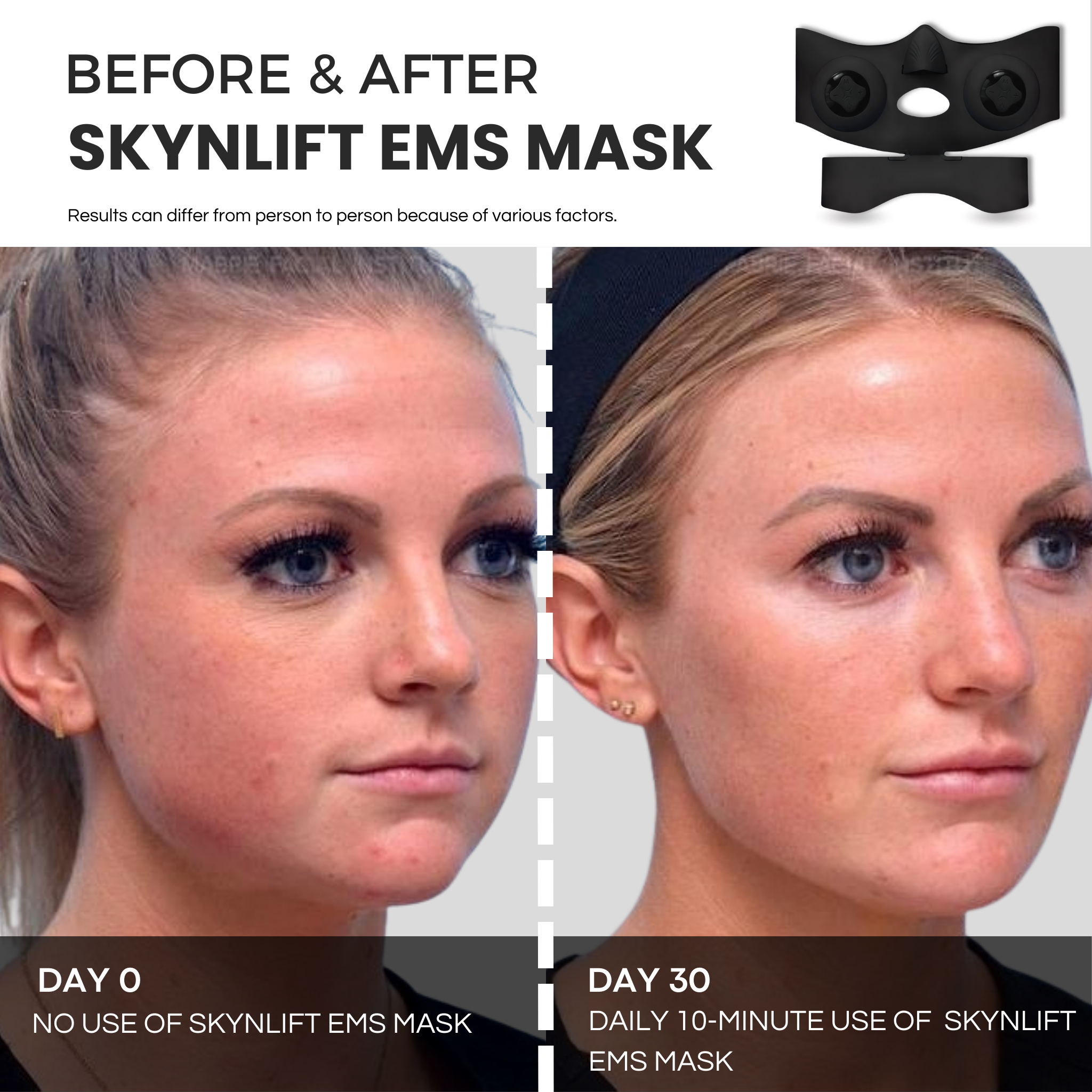 SKYNLIFT™ PRO-GRADE EMS MASK