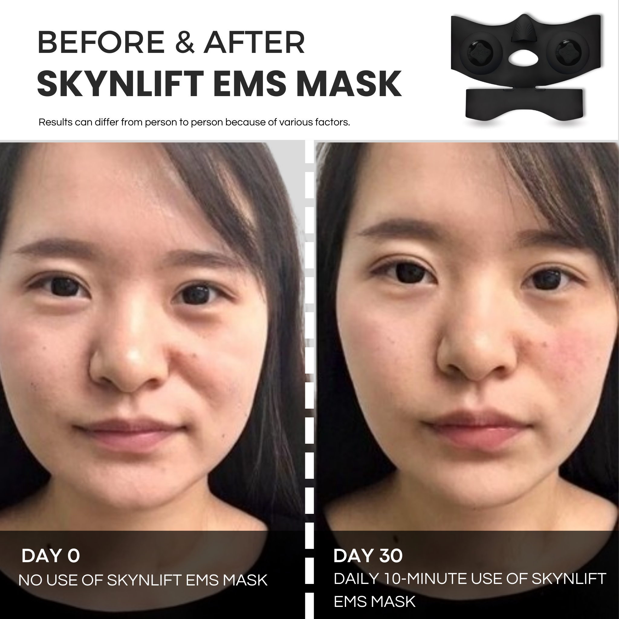 SKYNLIFT™ PRO-GRADE EMS MASK