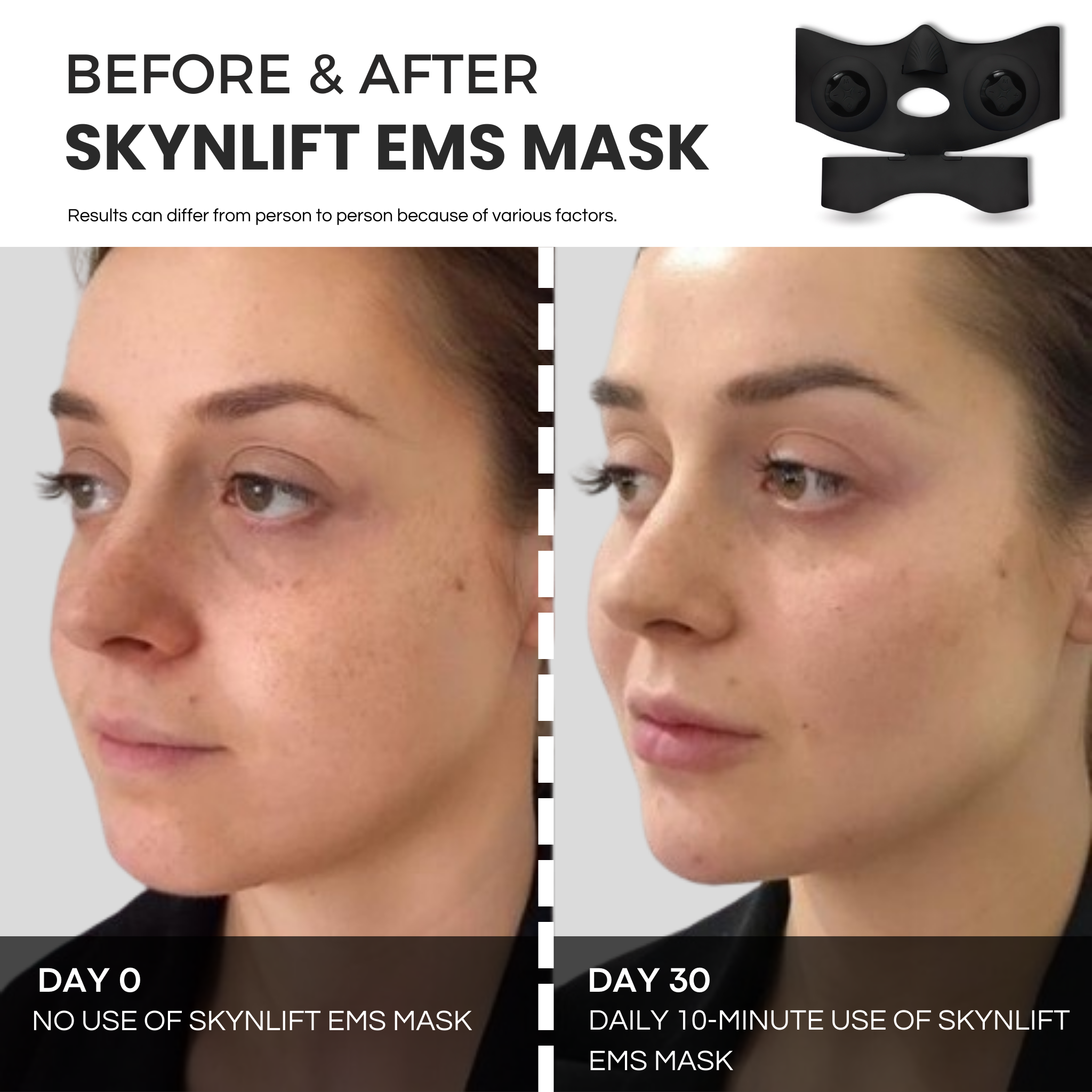 SKYNLIFT™ PRO-GRADE EMS MASK